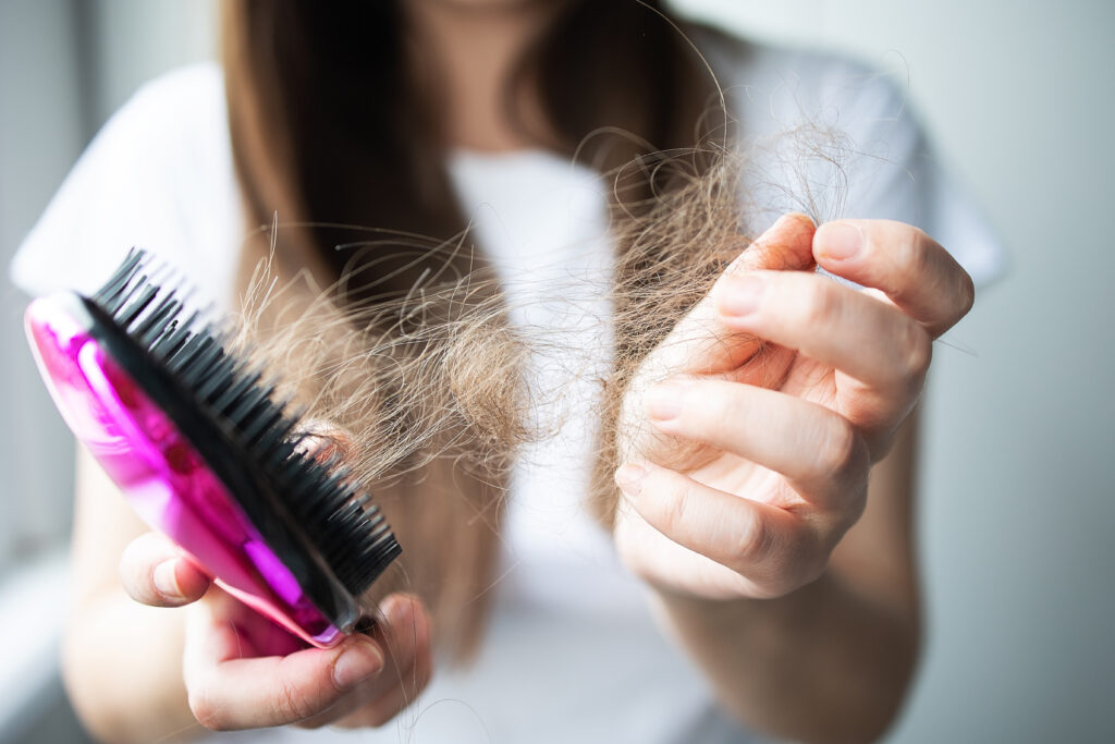 Hair loss from GLP-1 medications