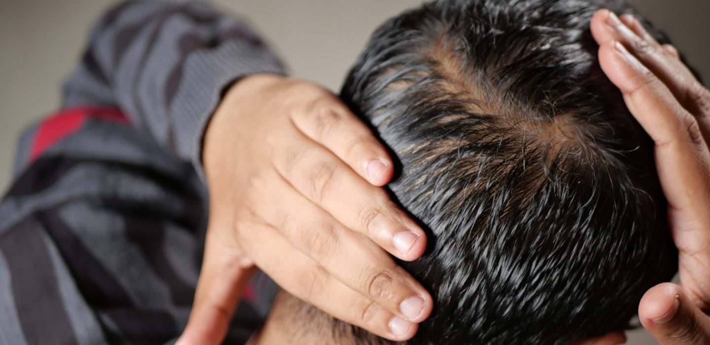 hair loss concept with man checking his hair .